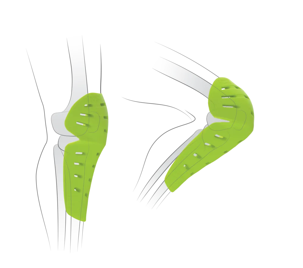 IXS Trigger Knee Pads